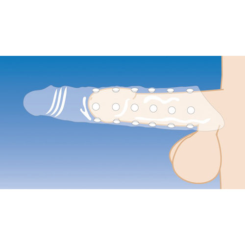 Vergrerung Penishlle mit Noppen - Transparent Vergrerung Penishlle mit Noppen - Transparent